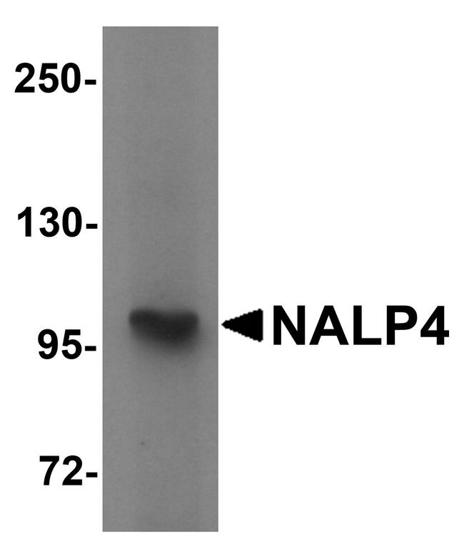 NALP4 Antibody in Western Blot (WB)