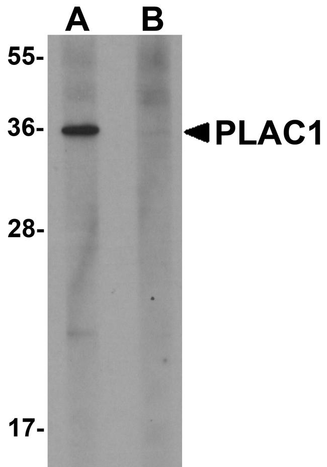 PLAC1 Antibody in Western Blot (WB)