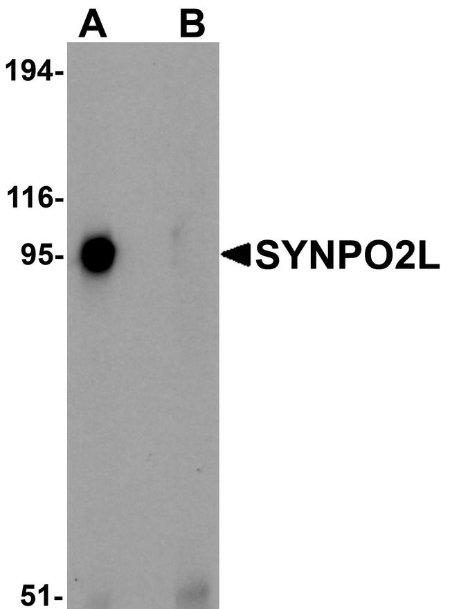 SYNPO2L Antibody in Western Blot (WB)