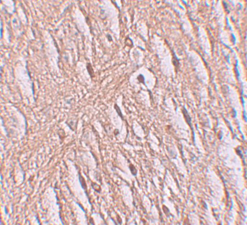 SLC39A9 Antibody in Immunohistochemistry (IHC)