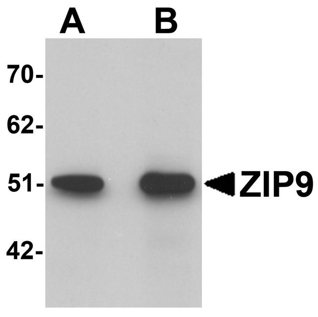 SLC39A9 Antibody in Western Blot (WB)