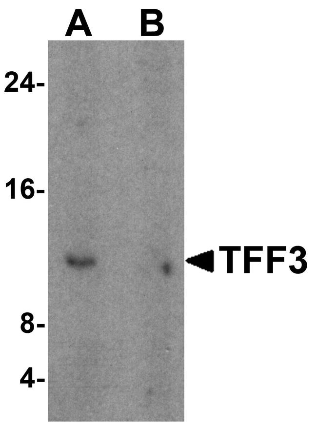 TFF3 Antibody in Western Blot (WB)