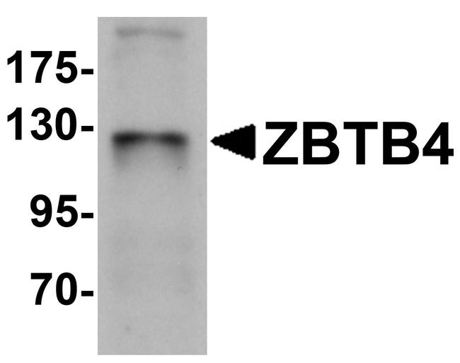 ZBTB4 Antibody in Western Blot (WB)