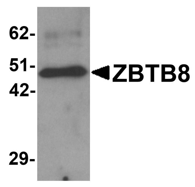 ZBTB8A Antibody in Western Blot (WB)