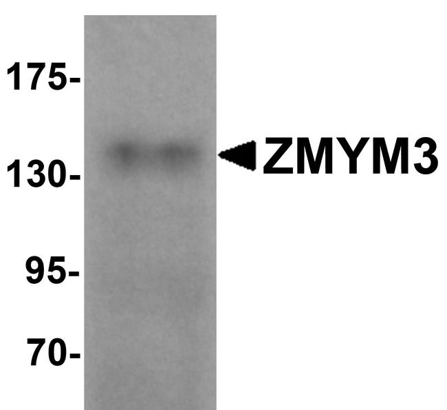 ZMYM3 Antibody in Western Blot (WB)