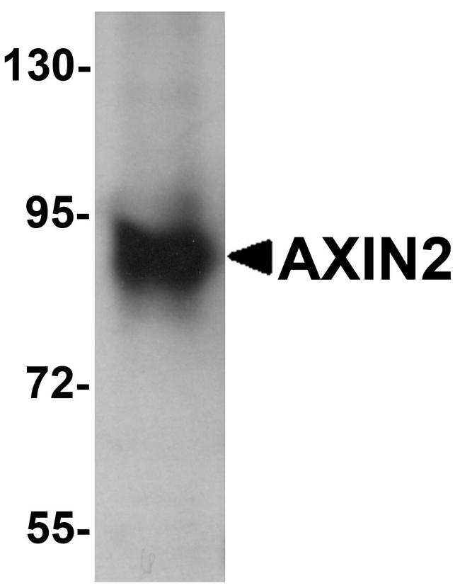 AXIN2 Antibody in Western Blot (WB)
