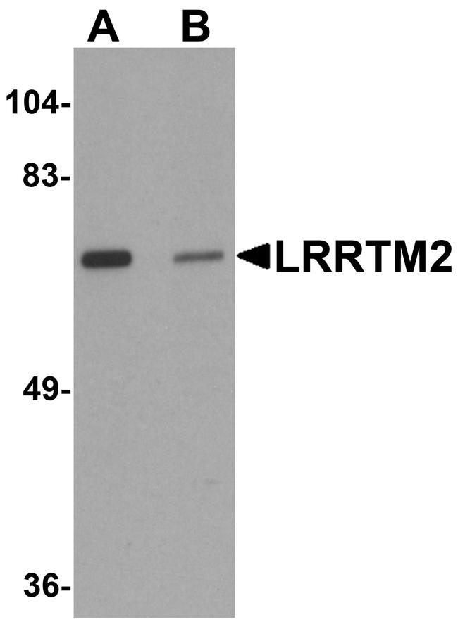 LRRTM2 Antibody in Western Blot (WB)