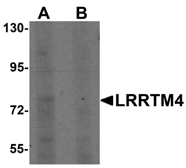 LRRTM4 Antibody in Western Blot (WB)