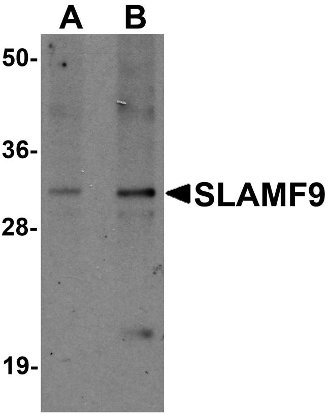 SLAMF9 Antibody in Western Blot (WB)