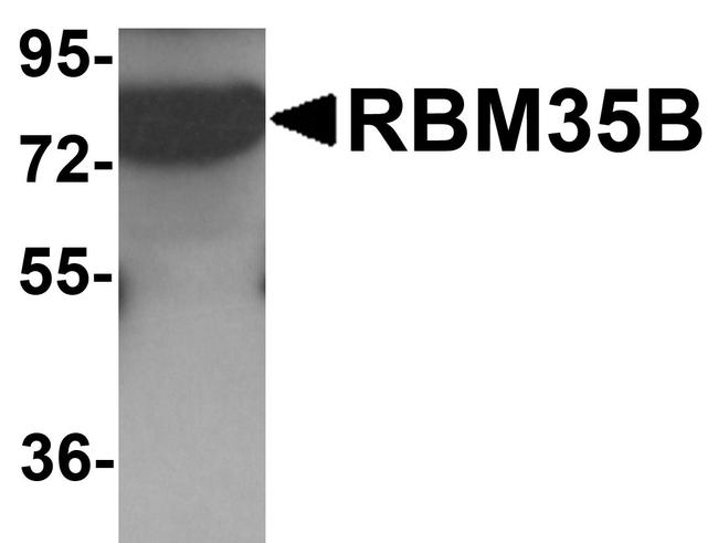 ESRP2 Antibody in Western Blot (WB)