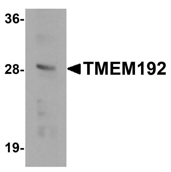 TMEM192 Antibody in Western Blot (WB)