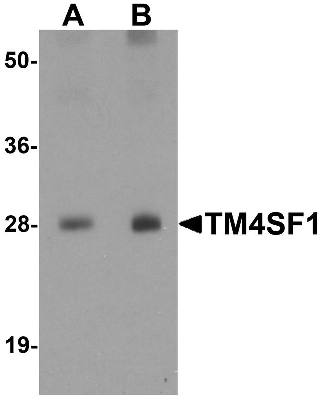 TM4SF1 Antibody in Western Blot (WB)
