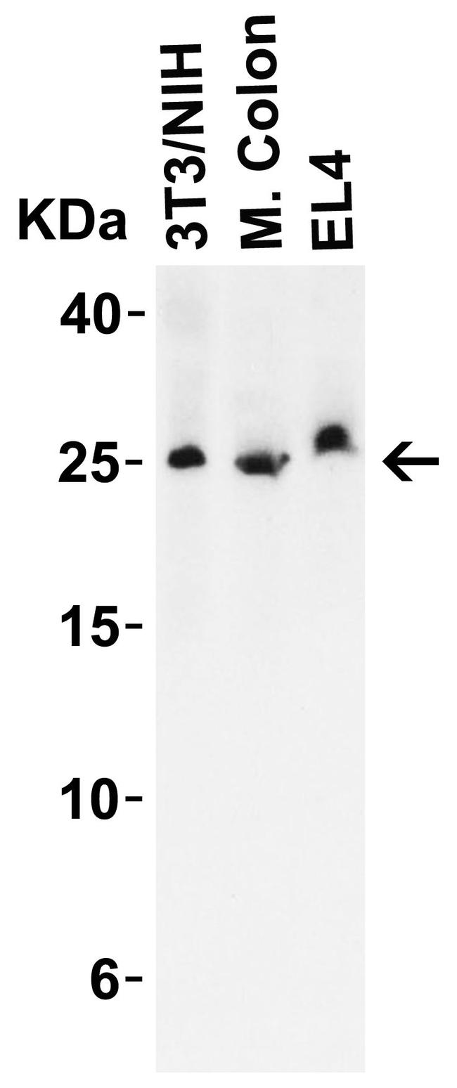 LIF Antibody in Western Blot (WB)