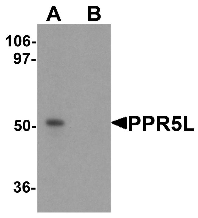 PRR5L Antibody in Western Blot (WB)