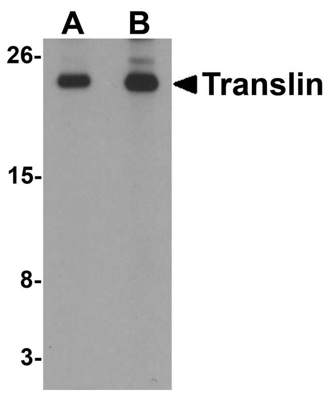 TSN Antibody in Western Blot (WB)