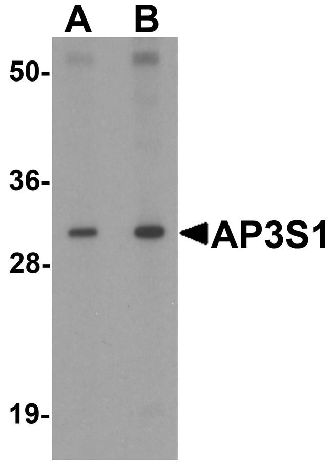 AP3S1 Antibody in Western Blot (WB)