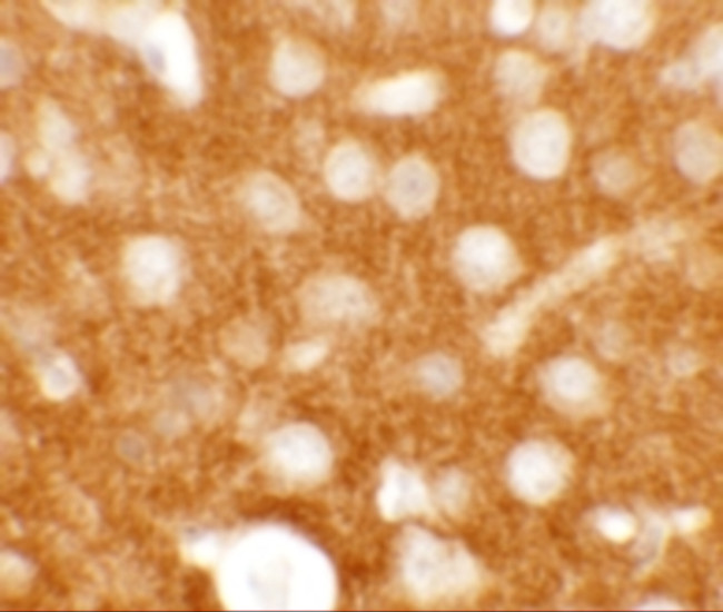 TMEM88 Antibody in Immunohistochemistry (IHC)