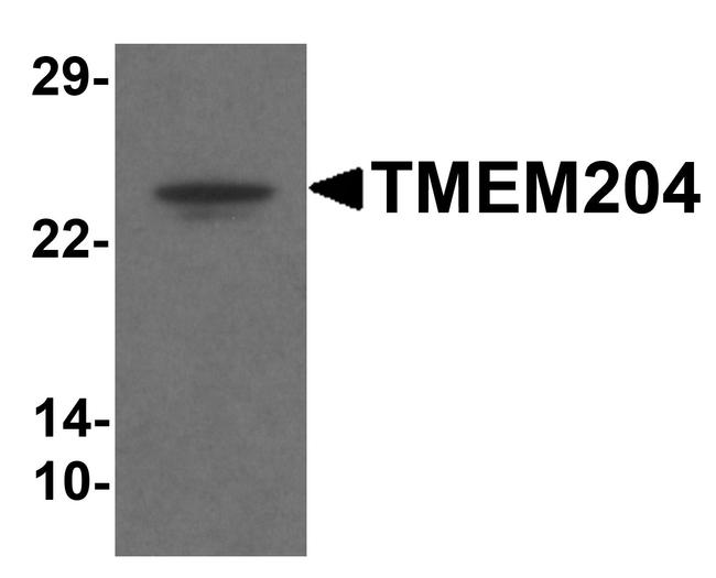 TMEM204 Antibody in Western Blot (WB)