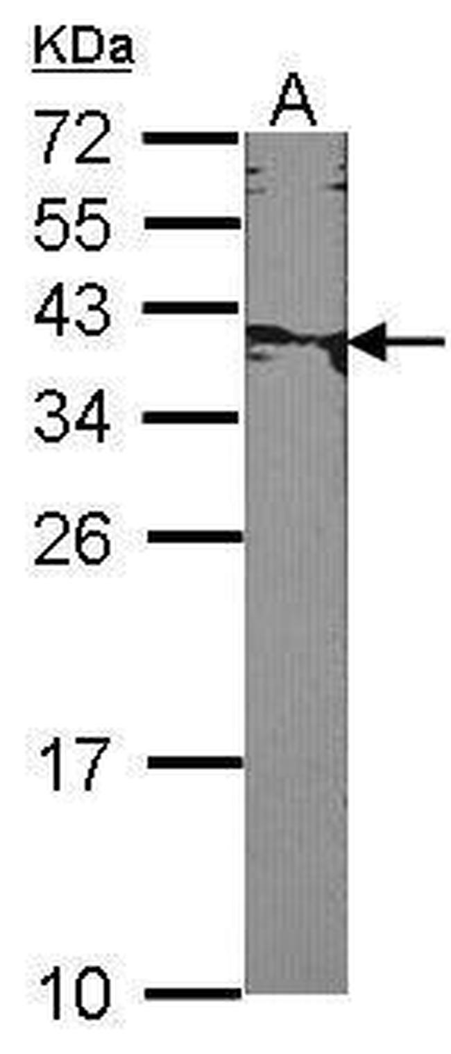 XRCC2 Antibody in Western Blot (WB)