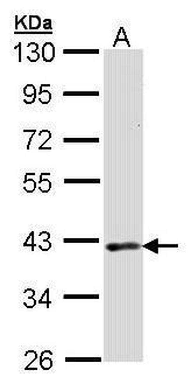 DMC1 Antibody in Western Blot (WB)
