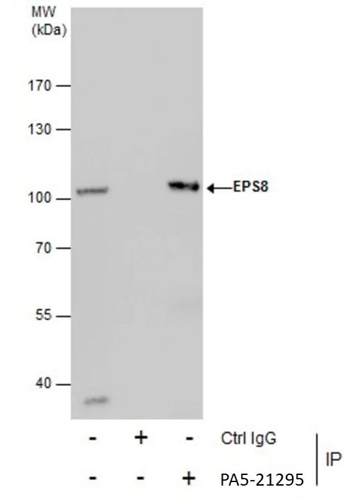 EPS8 Antibody in Immunoprecipitation (IP)