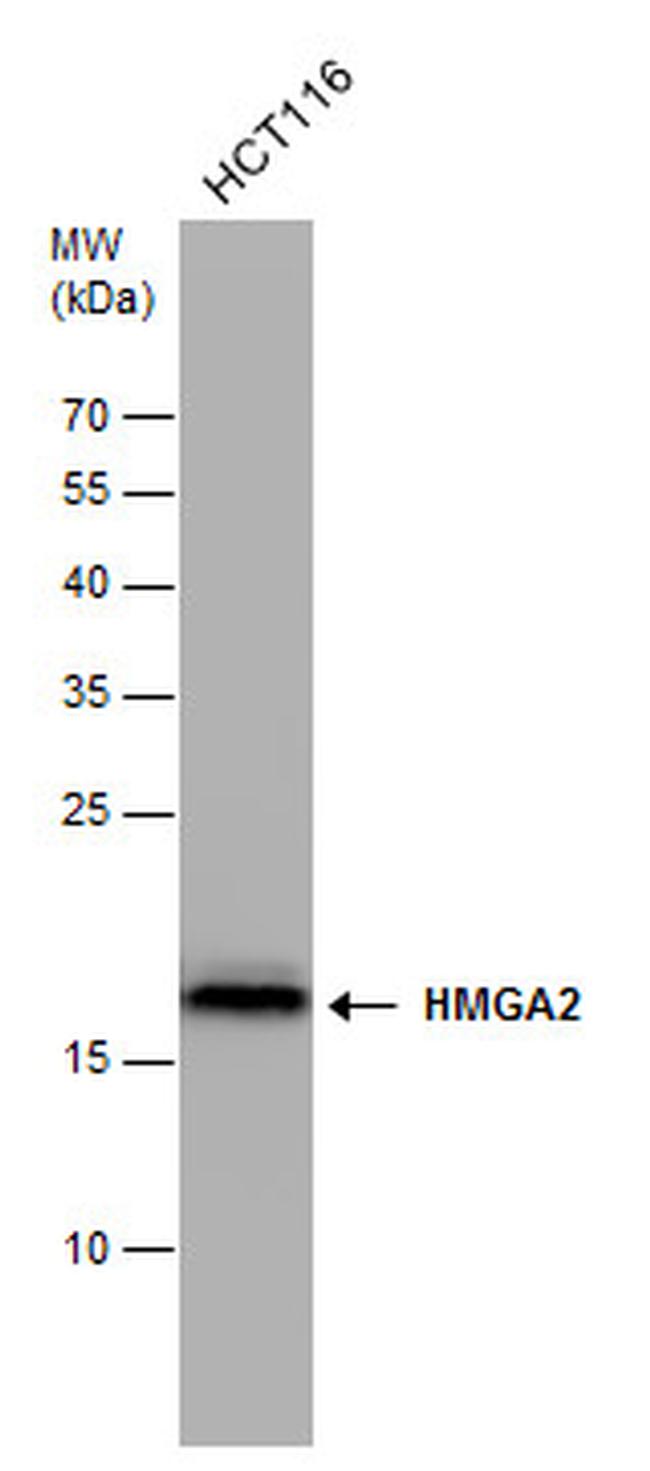 HMGA2 Antibody in Western Blot (WB)