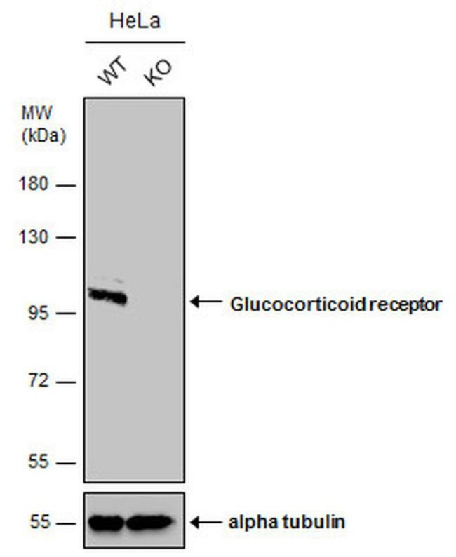 Glucocorticoid Receptor Antibody