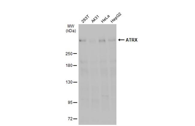 ATRX Antibody in Western Blot (WB)