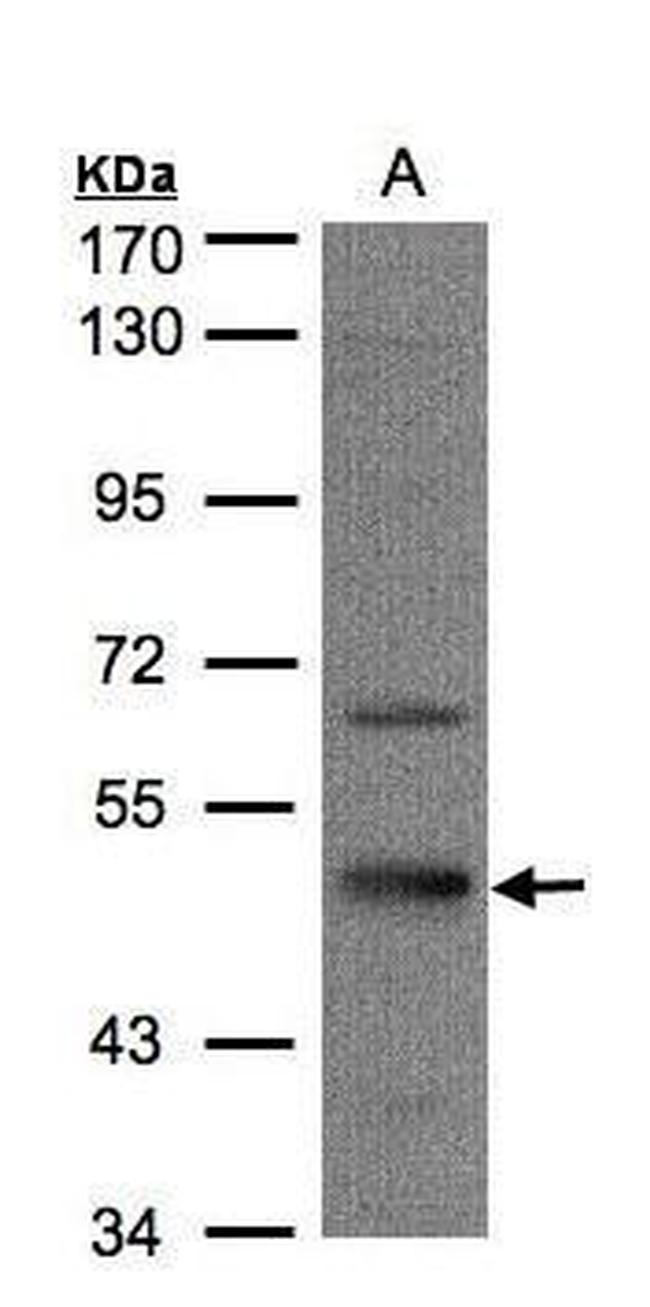 Septin-7 Antibody in Western Blot (WB)