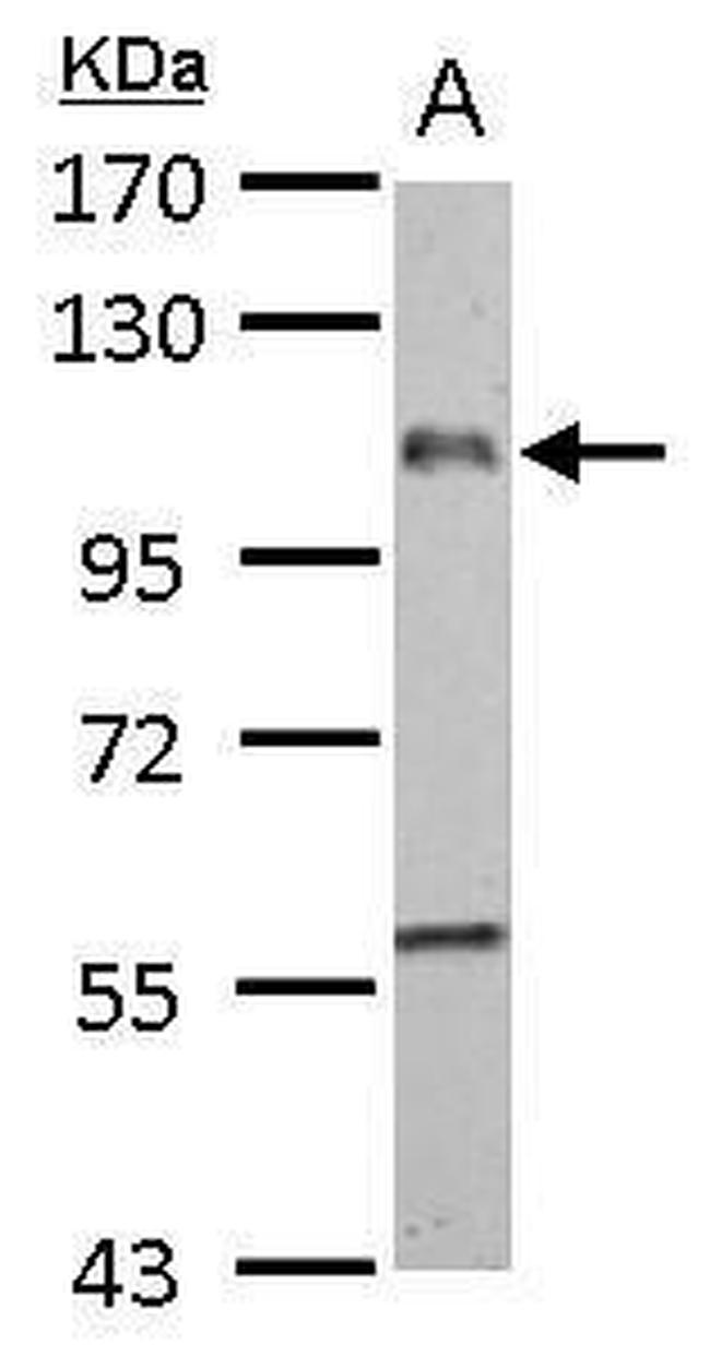 EMR1 Antibody in Western Blot (WB)