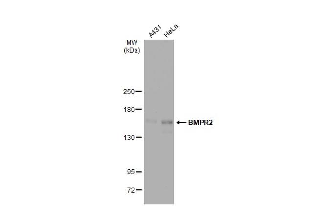 BMPR2 Antibody in Western Blot (WB)