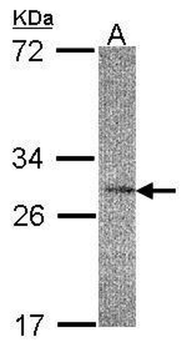 IL22RA2 Antibody in Western Blot (WB)