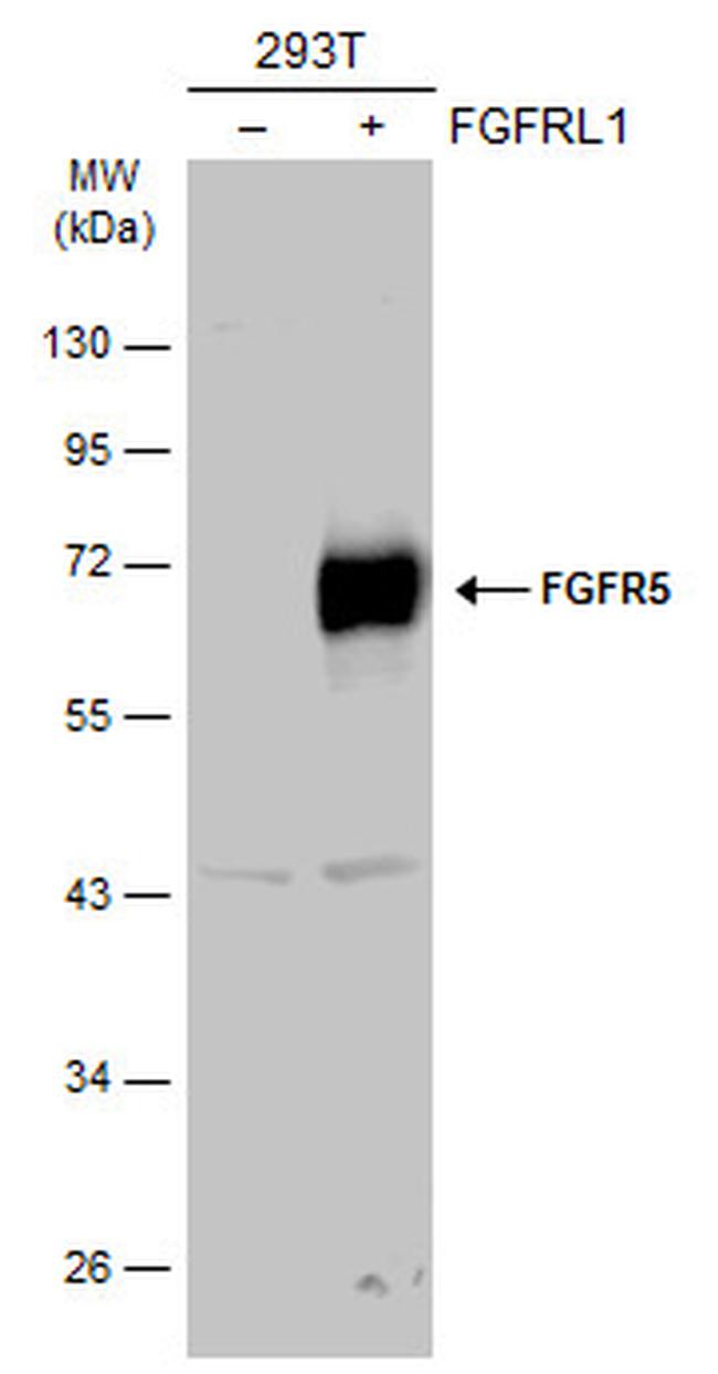 FGFR5 Antibody in Western Blot (WB)