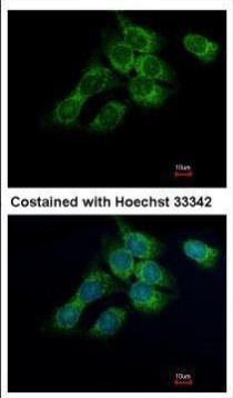 HSD17B4 Antibody in Immunocytochemistry (ICC/IF)