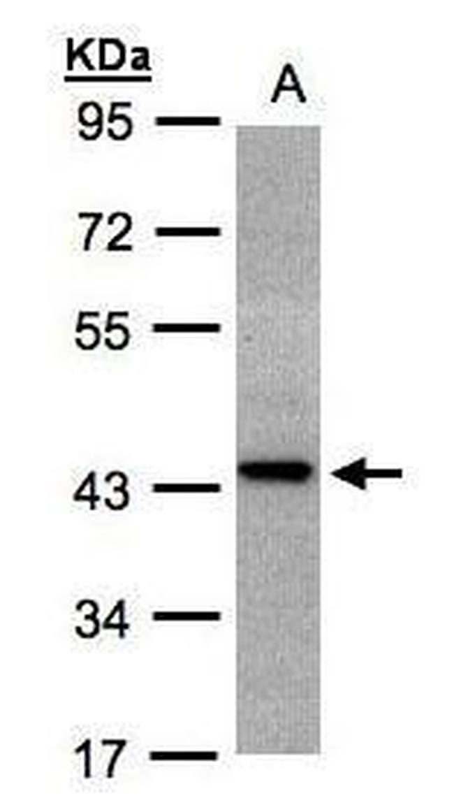 ST3GAL2 Antibody in Western Blot (WB)