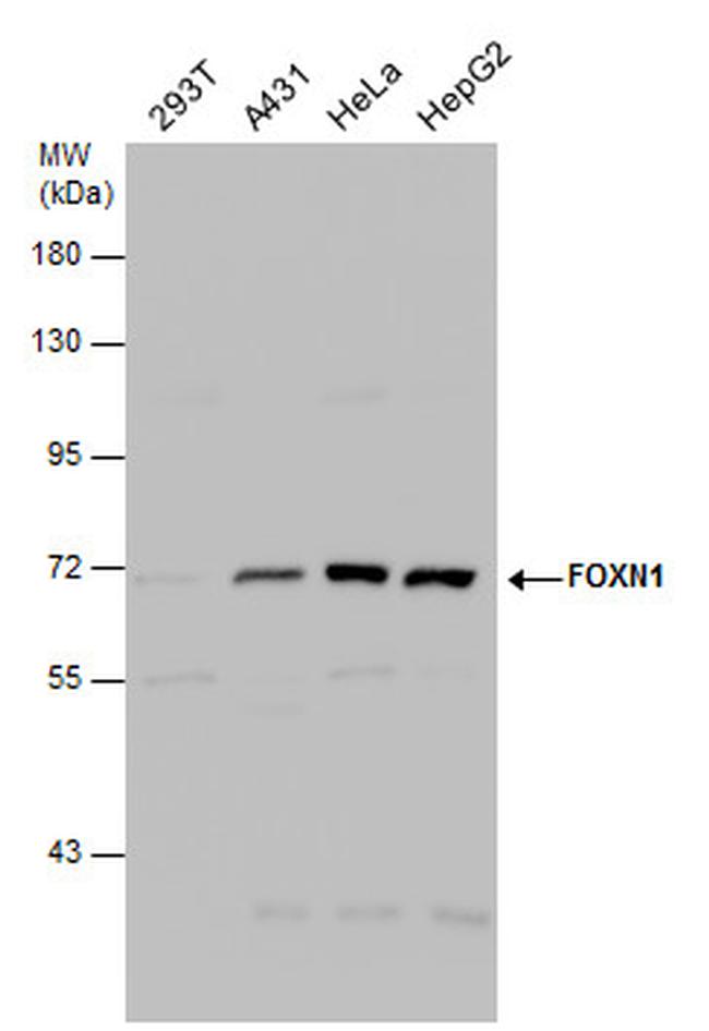 FOXN1 Antibody in Western Blot (WB)