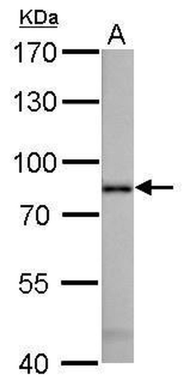 Radixin Antibody in Western Blot (WB)
