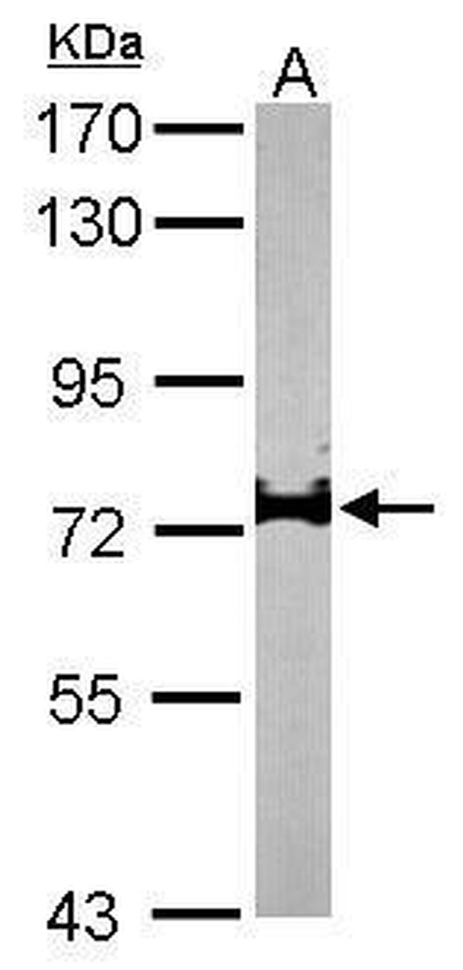 IL17RD Antibody in Western Blot (WB)