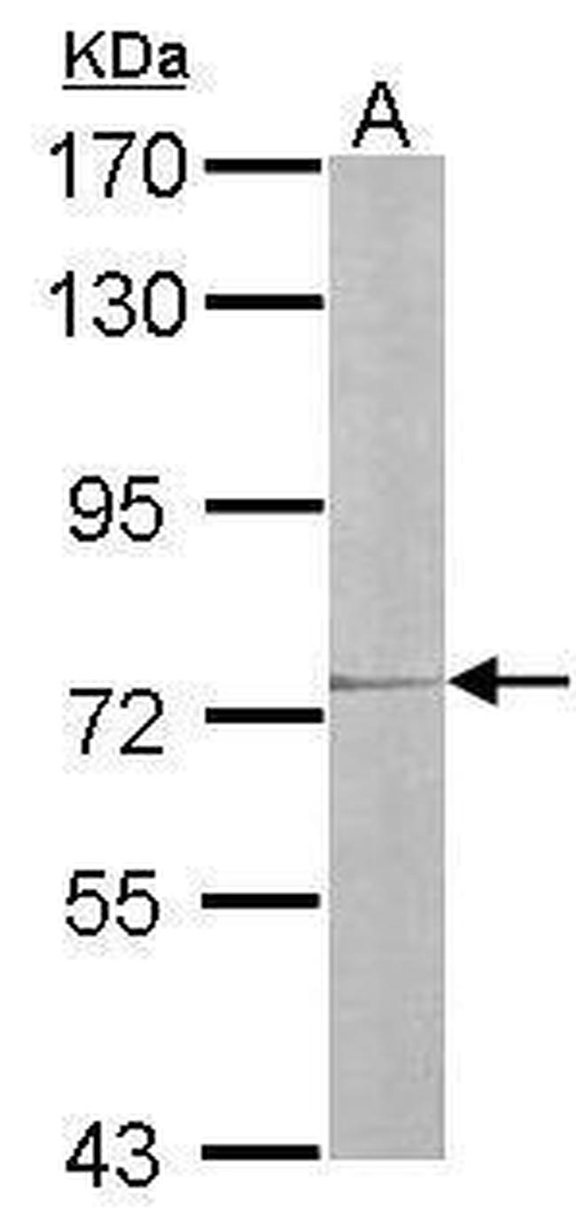 IL17RD Antibody in Western Blot (WB)