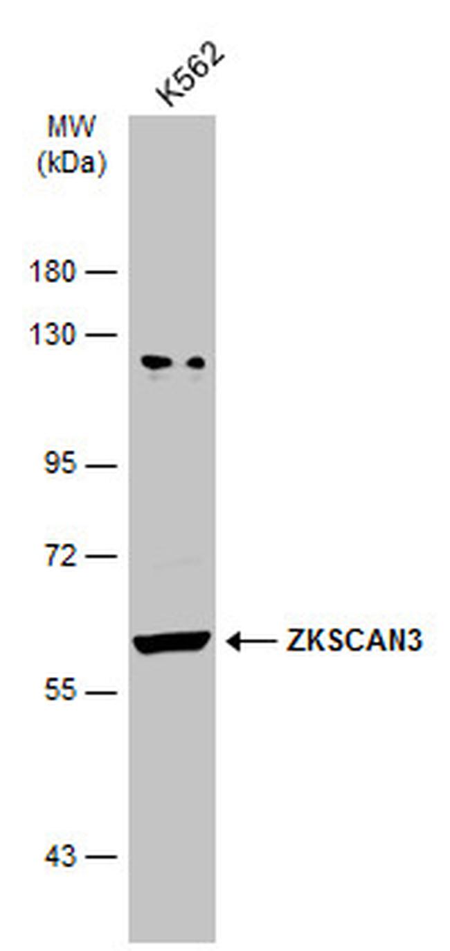 ZNF306 Antibody in Western Blot (WB)