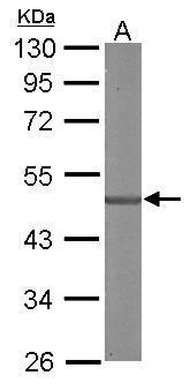 SDCCAG3 Isoform 1 Antibody in Western Blot (WB)
