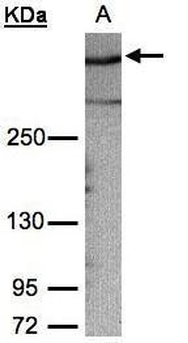 AKAP12 Antibody in Western Blot (WB)