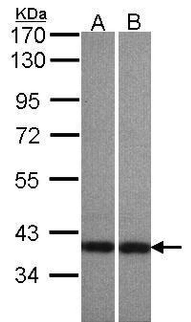 Centaurin alpha-1 Antibody in Western Blot (WB)