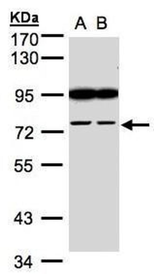 FSD2 Antibody in Western Blot (WB)