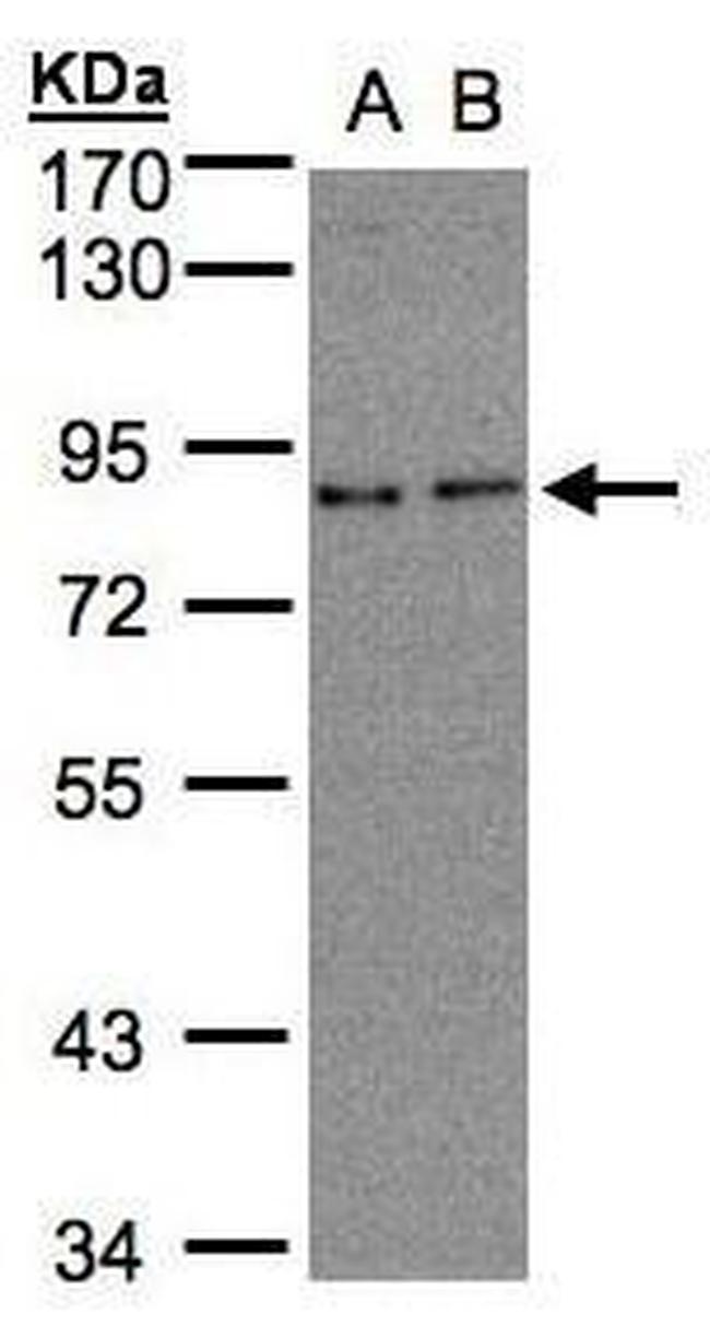ZER1 Antibody in Western Blot (WB)