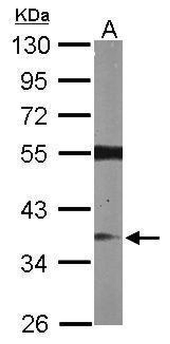 RASSF2 Antibody in Western Blot (WB)