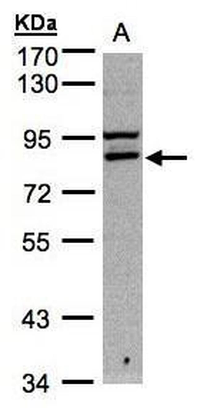 FASTKD1 Antibody in Western Blot (WB)