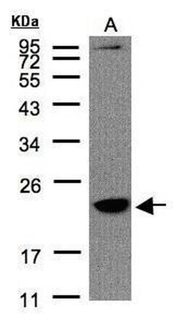 TMEM147 Antibody in Western Blot (WB)