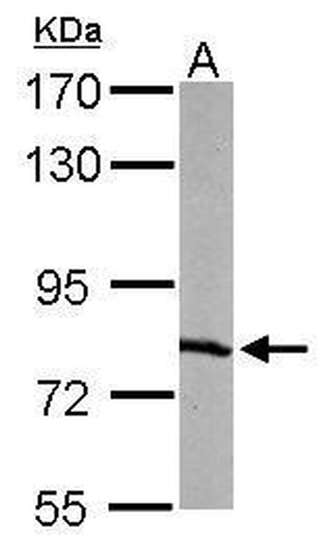 RPA70 Antibody in Western Blot (WB)