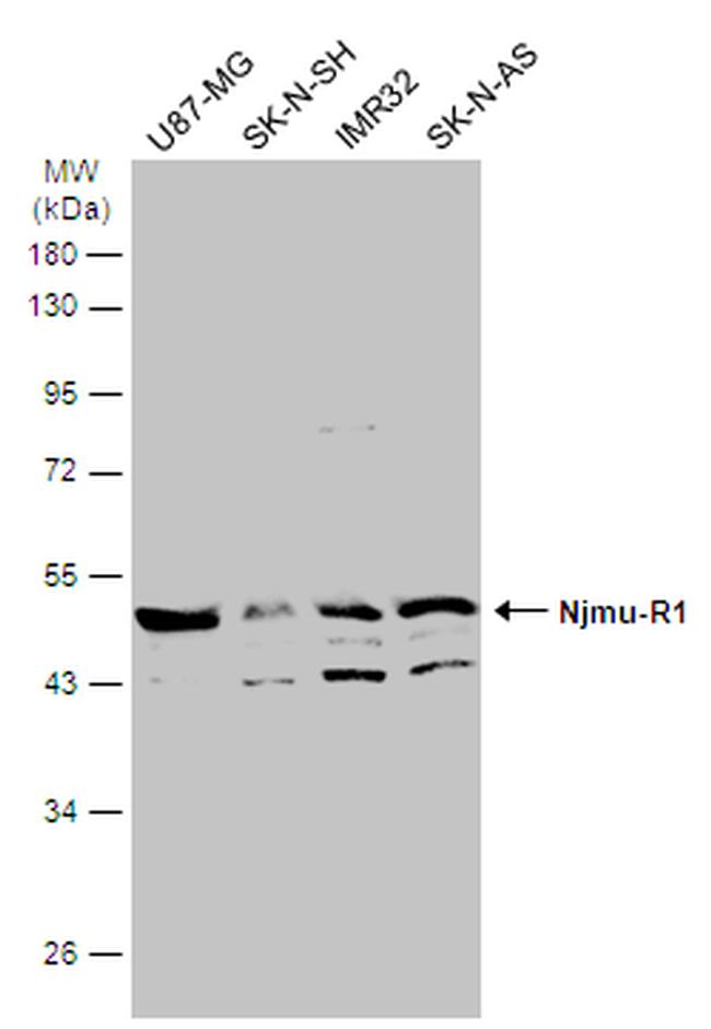 Njmu-R1 Antibody in Western Blot (WB)
